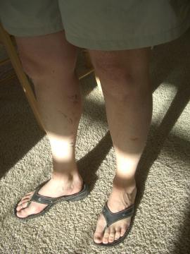 messy legs after mtn biking!  yeah!